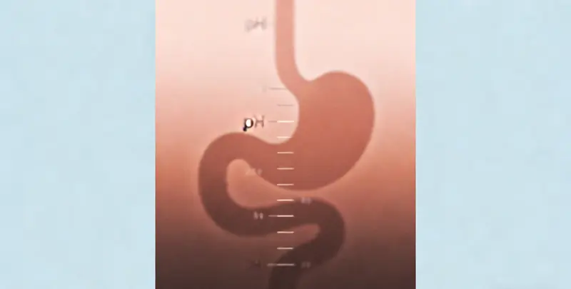 胃癌甲基化检测图3